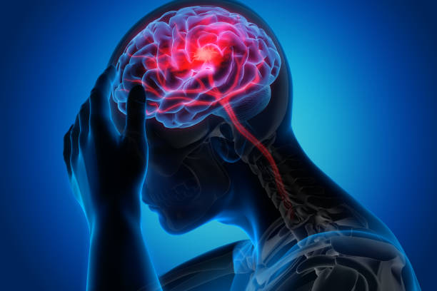 Nerve Disorders